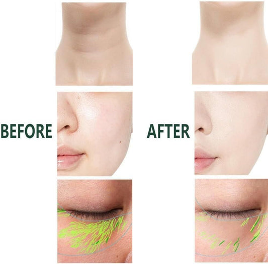 2 In 1 Anti Wrinkles Facial Massager For Skin Care