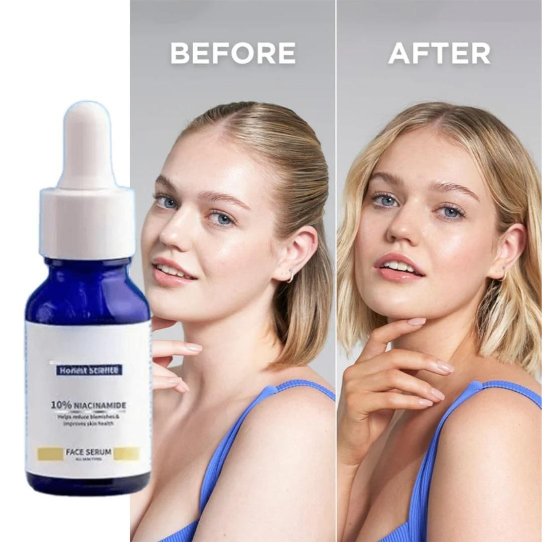 Niacinamide Brightening Face Serum 30ml Each Pack of 2