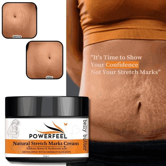 Natural Stretch Marks Cream 50g