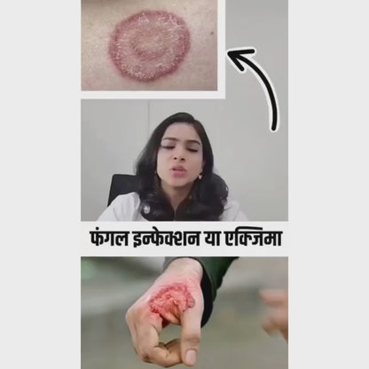 Anti Fungal originalCream (pack of 2)