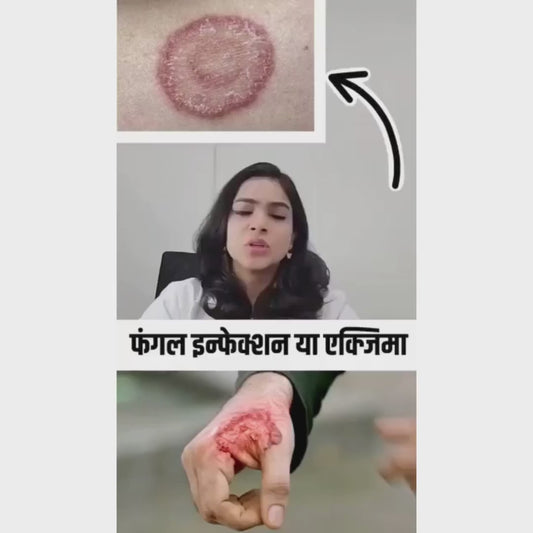 Anti Fungal originalCream (pack of 2)